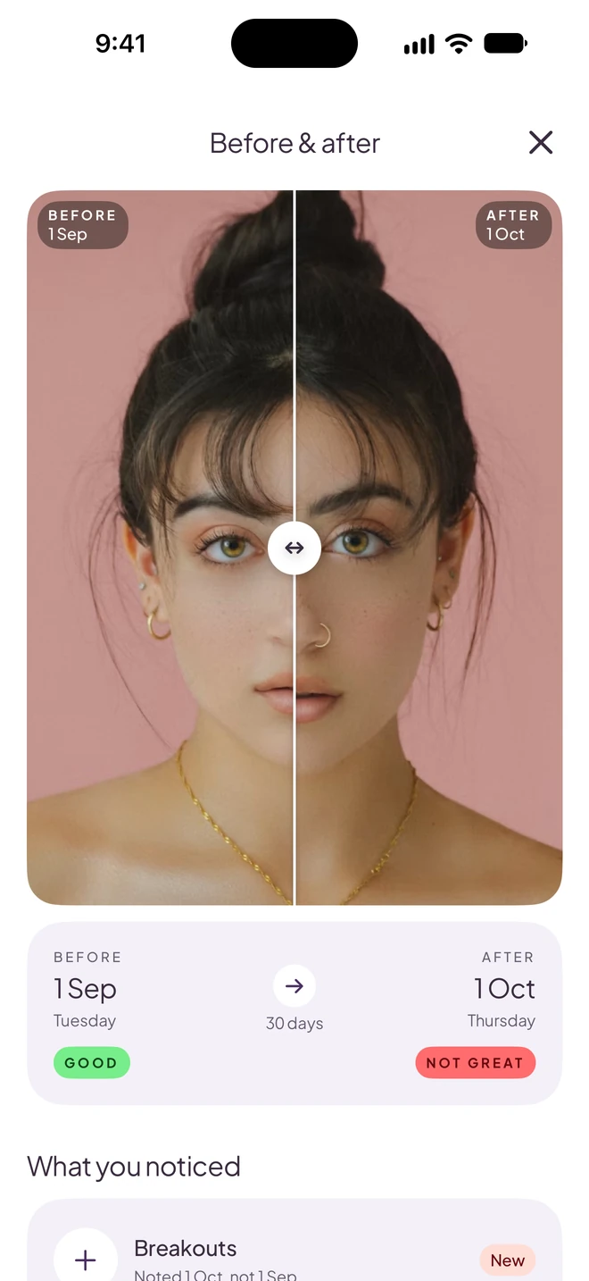 Before and after: two skin photos a month apart, side by side